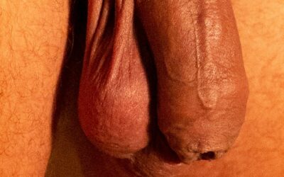 Prepuce